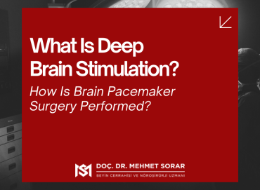 What Is Deep Brain Stimulation? How Is Brain Pacemaker Surgery Performed?