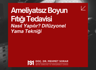 Ameliyatsız Boyun Fıtığı Tedavisi: Difüzyonel Yama Yöntemi