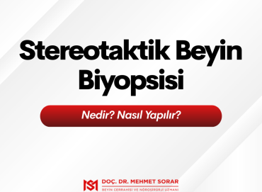 Stereotaktik Beyin Biyopsisi Nedir? Nasıl Yapılır?