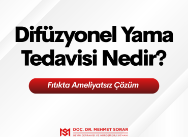 Difüzyonel Yama Tedavisi Nedir? Fıtıkta Ameliyatsız Çözüm 
