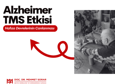 Alzheimer TMS Etkisi: Hafıza Devrelerinin Canlanması