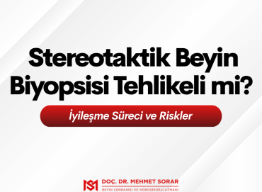  Stereotaktik Beyin Biyopsisi Tehlikeli mi? İyileşme Süreci ve Riskler