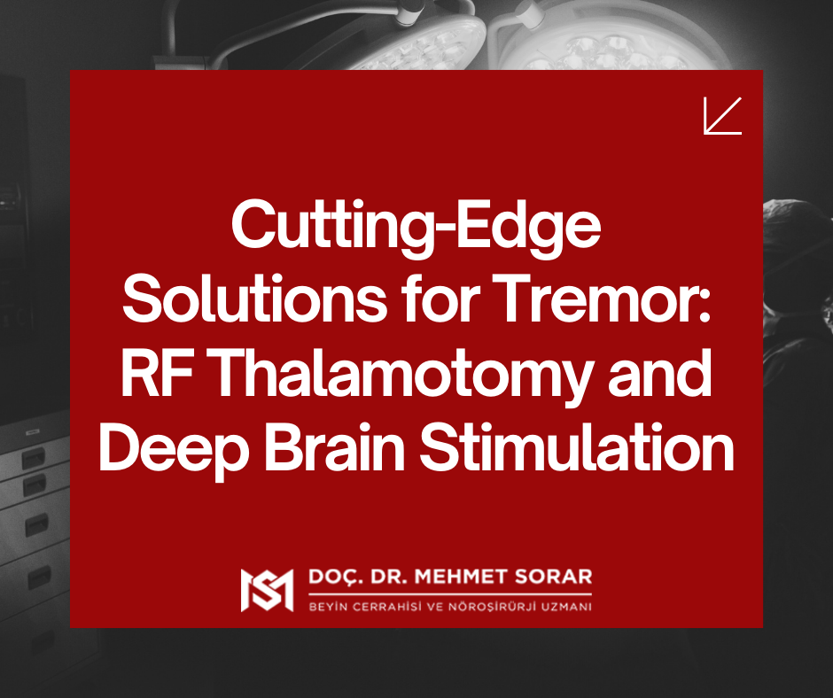 Cutting-Edge Solutions for Tremor: RF Thalamotomy and Deep Brain Stimulation