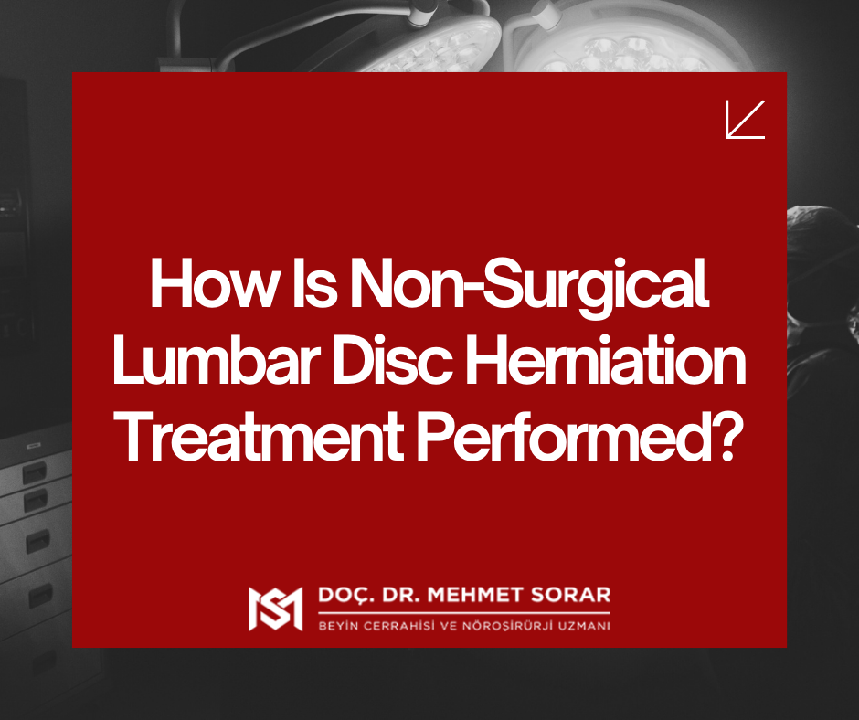 How Is Non-Surgical Lumbar Disc Herniation Treatment Performed? Diffusional Patch Technique