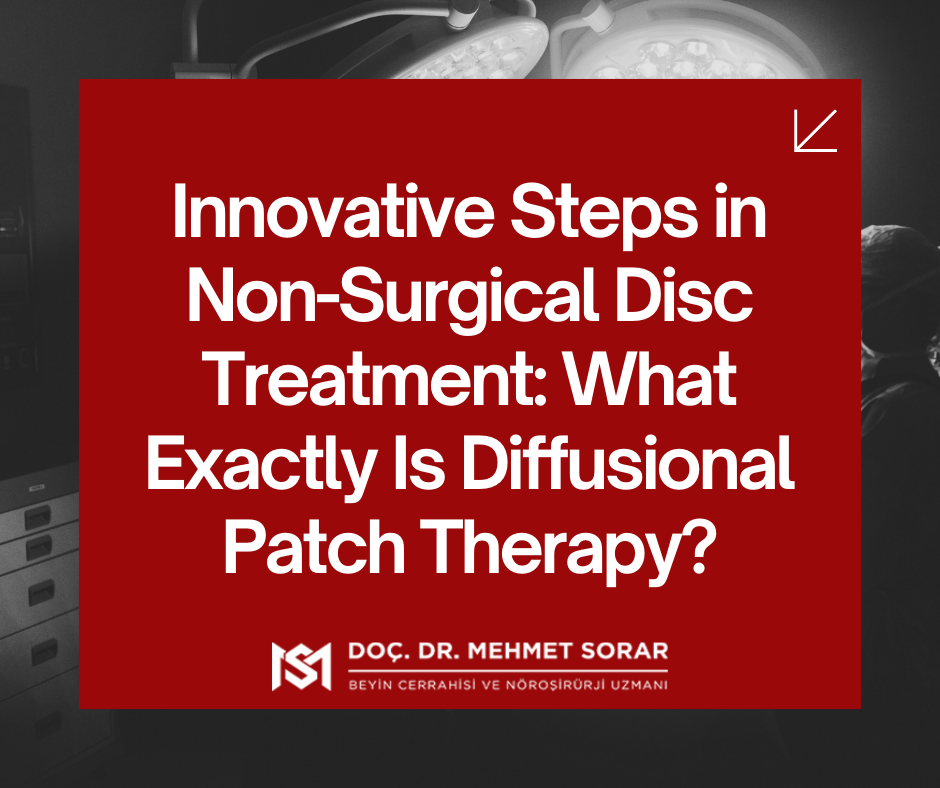 Innovative Steps in Non-Surgical Disc Treatment: What Exactly Is Diffusional Patch Therapy?