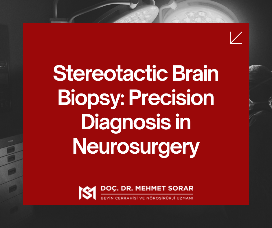 Stereotactic Brain Biopsy: Precision Diagnosis in Neurosurgery