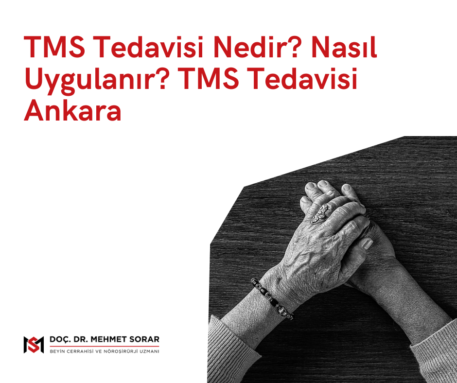 TMS Tedavisi Nedir? Nasıl Uygulanır? TMS Tedavisi Ankara 