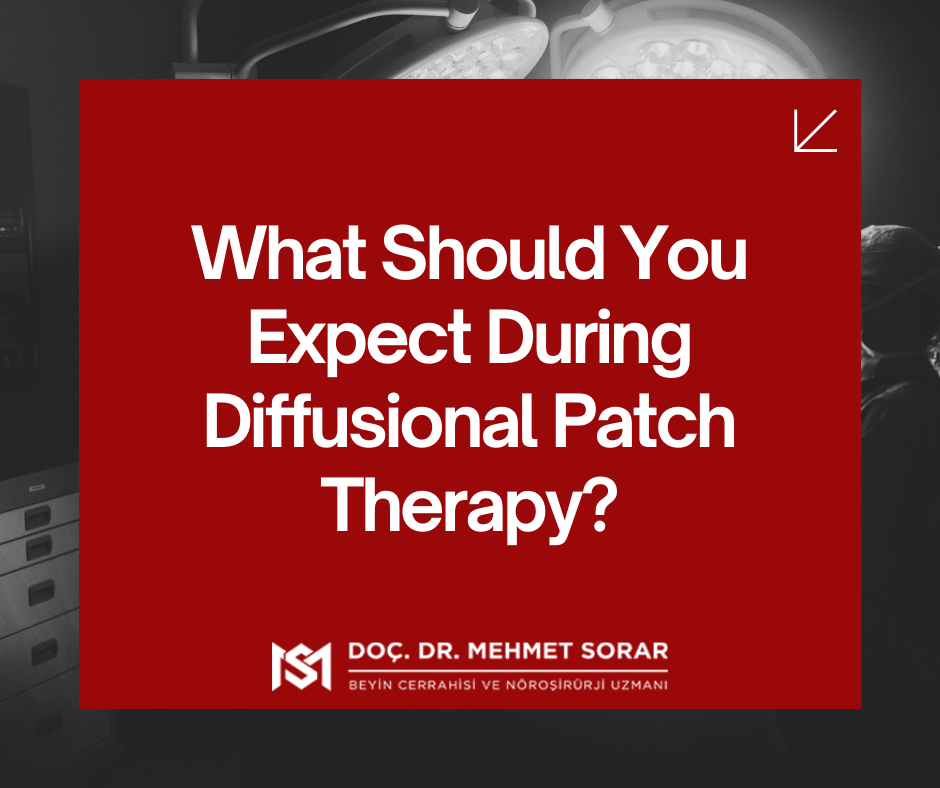 What Should You Expect During Diffusional Patch Therapy?