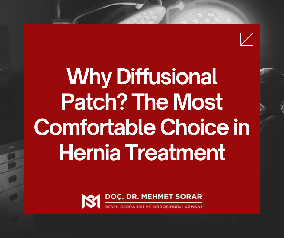 Why Diffusional Patch? The Most Comfortable Choice in Hernia Treatment