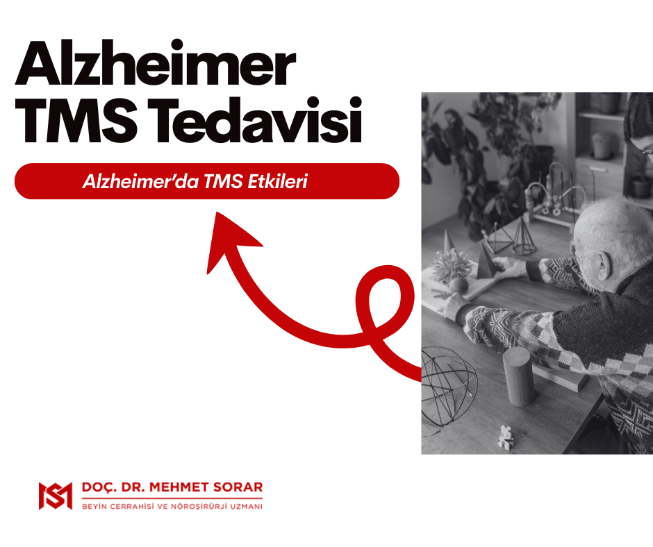 Alzheimer Transkraniyal Manyetik Stimülasyon (TMS) Tedavisi: Alzheimer’da TMS Etkileri