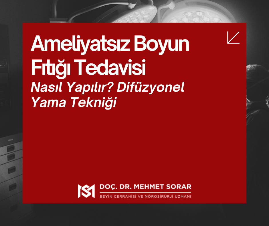 Ameliyatsız Boyun Fıtığı Tedavisi: Difüzyonel Yama Yöntemi