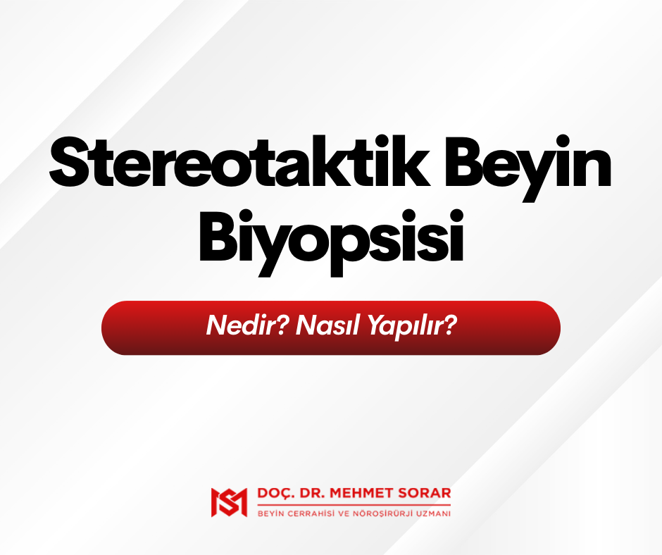 Stereotaktik Beyin Biyopsisi Nedir? Nasıl Yapılır?