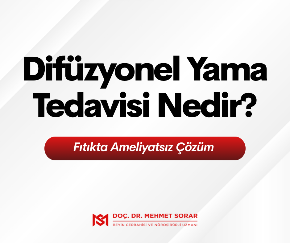 Difüzyonel Yama Tedavisi Nedir? Fıtıkta Ameliyatsız Çözüm 