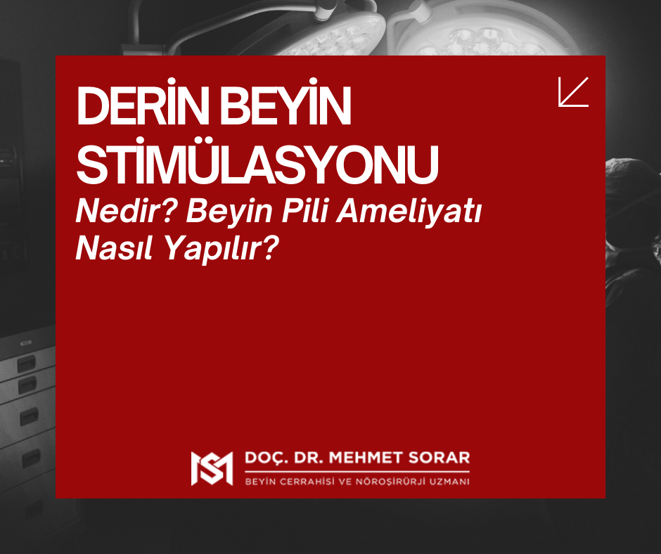 Derin Beyin Stimülasyonu Nedir? Beyin Pili Ameliyatı Nasıl Yapılır?