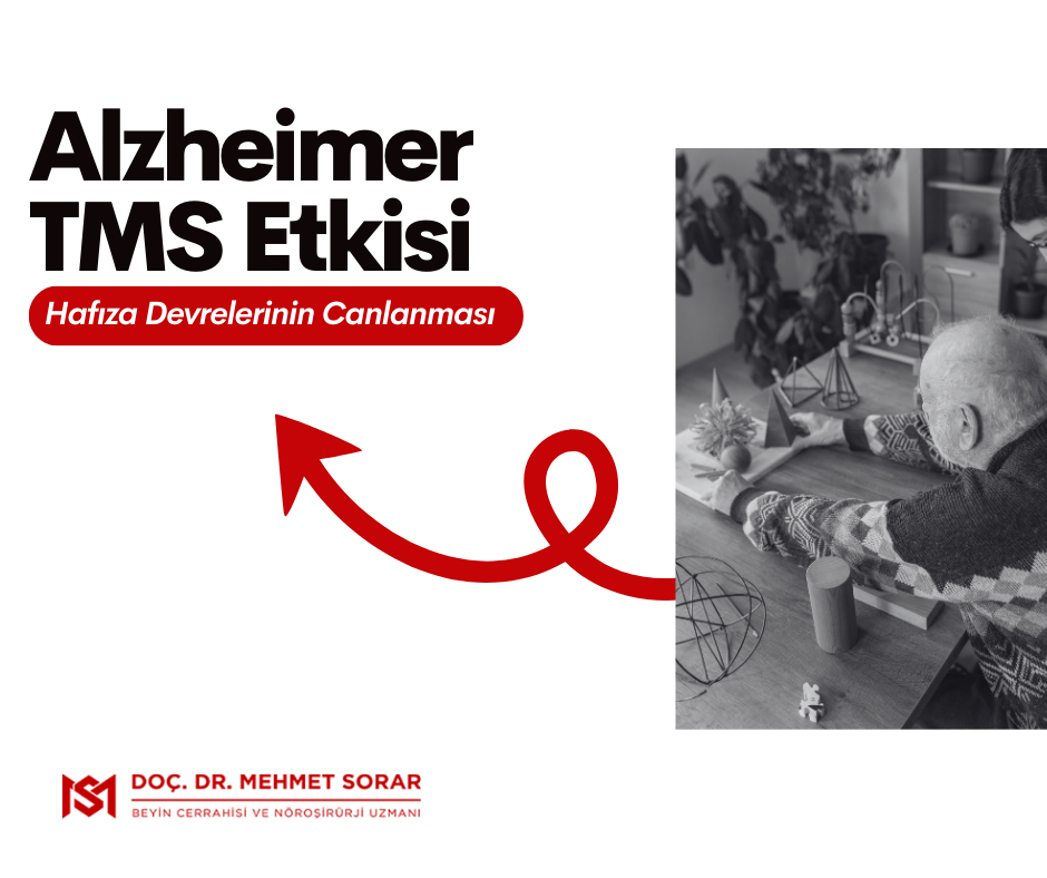 Alzheimer TMS Etkisi: Hafıza Devrelerinin Canlanması