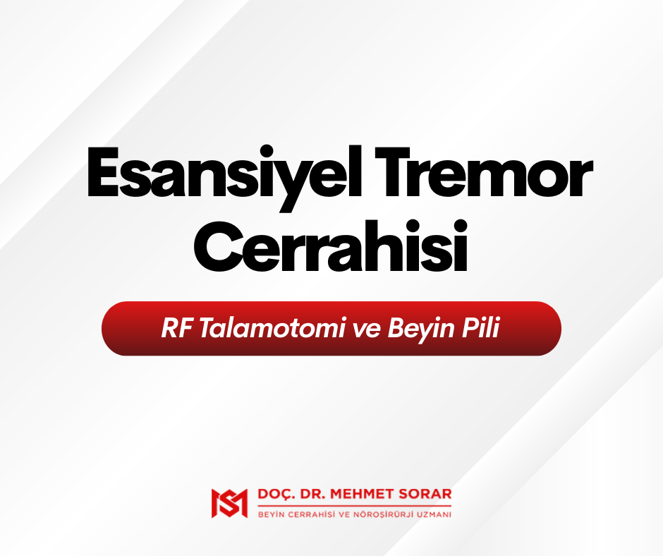  Esansiyel Tremor Cerrahisi: RF Talamotomi ve Beyin Pili 