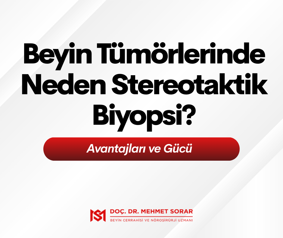 Beyin Tümörlerinde Neden Stereotaktik Biyopsi? Avantajları ve Gücü 